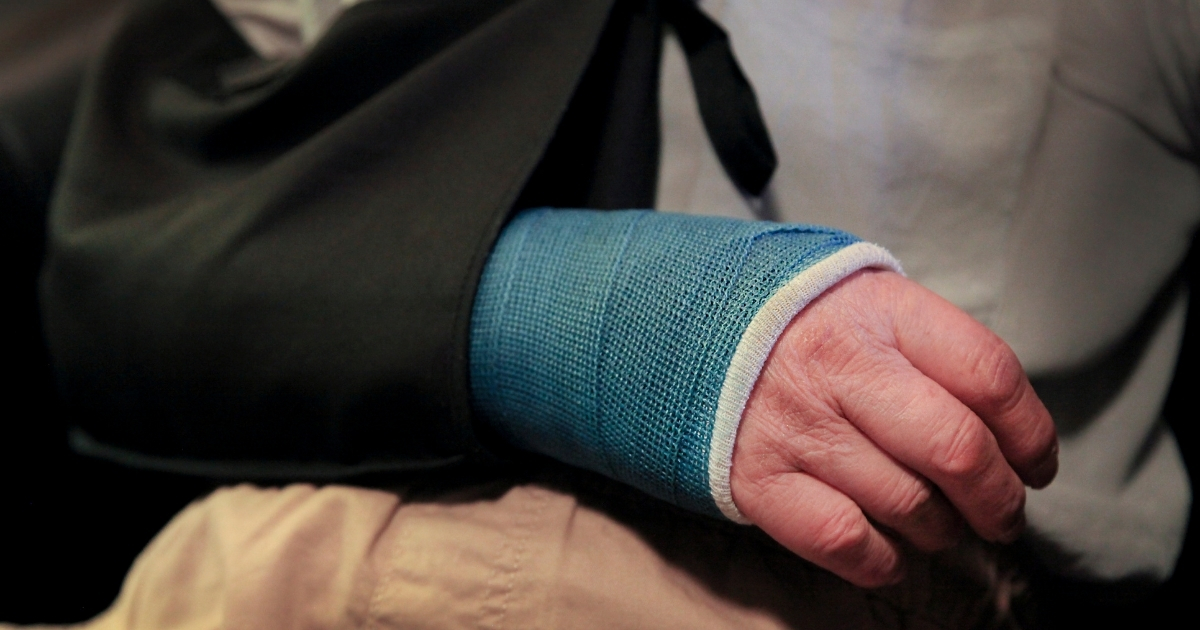 Broken bone